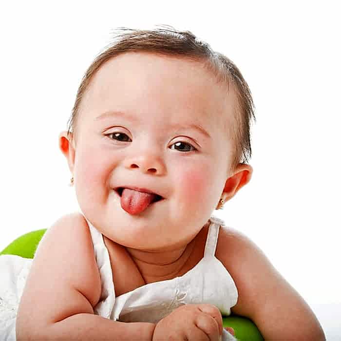 Otizmde Dil ve Konuşma Terapisi